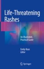 Life-Threatening Rashes - ISBN 9783319756226