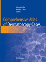 Comprehensive Atlas of Dermatoscopy Cases - ISBN 9783319769318