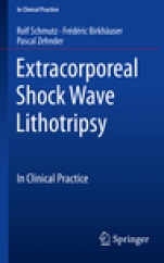 Extracorporeal Shock Wave Lithotripsy - ISBN 9783319776392