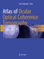 Atlas of Ocular Optical Coherence Tomography - ISBN 9783319883144