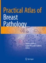 Practical Atlas of Breast Pathology  - ISBN 9783319932569