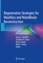 Regenerative Strategies for Maxillary and Mandibular Reconstruction - ISBN 9783319936673