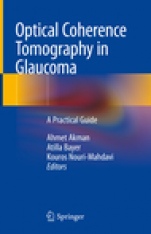 Optical Coherence Tomography in Glaucoma - ISBN 9783319949048