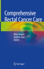 Comprehensive Rectal Cancer Care - ISBN 9783319989013