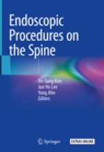 Endoscopic Procedures on the Spine - ISBN 9789811039041