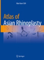 Atlas of Asian Rhinoplasty - ISBN 9789811086441