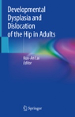 Developmental Dysplasia and Dislocation of the Hip in Adults - ISBN 9789811304132