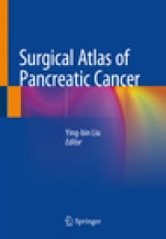 Surgical Atlas of Pancreatic Cancer - ISBN 9789813298637
