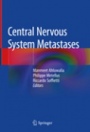 Central Nervous System Metastases - ISBN 9783030234164