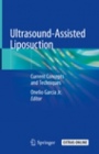 Ultrasound-Assisted Liposuction - ISBN 9783030268749