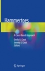 Hammertoes - ISBN 9783319165516