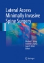 Lateral Access Minimally Invasive Spine Surgery - ISBN 9783319283180