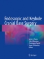 Endoscopic and Keyhole Cranial Base Surgery  - ISBN 9783319643786