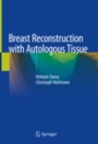 Breast Reconstruction with Autologous Tissue - ISBN 9783319954677