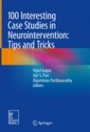 100 Interesting Case Studies in Neurointervention: Tips and Tricks - ISBN 9789811313455