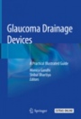 Glaucoma Drainage Devices - ISBN 9789811357725