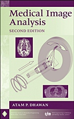 Medical Image Analysis - ISBN 9780470622056