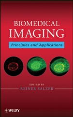Biomedical Imaging: Principles and Applications - ISBN 9780470648476