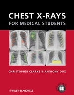 Chest X–rays for Medical Students - ISBN 9780470656198