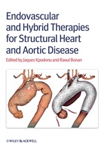 Endovascular and Hybrid Therapies for Structural Heart and Aortic Disease - ISBN 9780470656396