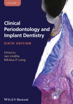 Clinical Periodontology and Implant Dentistry, 2 Volume Set - ISBN 9780470672488