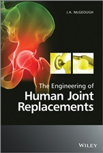 The Engineering of Human Joint Replacements - ISBN 9780470740279