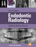 Endodontic Radiology - ISBN 9780470958490