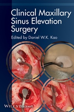Clinical Maxillary Sinus Elevation Surgery - ISBN 9780470960738