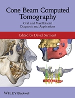 Cone Beam Computed Tomography: Oral and Maxillofacial Diagnosis and Applications - ISBN 9780470961407