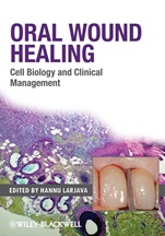 Oral Wound Healing: Cell Biology and Clinical Management - ISBN 9780813804811