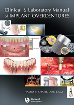 Clinical and Laboratory Manual of Implant Overdentures - ISBN 9780813808819