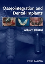 Osseointegration and Dental Implants - ISBN 9780813813417