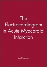 The Electrocardiogram in Acute Myocardial Infarction - ISBN 9780879936938