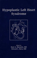 Hypoplastic Left Heart Syndrome - ISBN 9780879937041