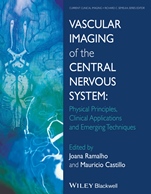 Vascular Imaging of the Central Nervous System: Physical Principles, Clinical Applications, and Emerging Techniques - ISBN 9781118188750