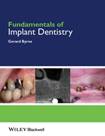 Fundamentals of Implant Dentistry - ISBN 9781118274965