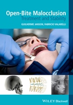 Open–Bite Malocclusion: Treatment and Stability - ISBN 9781118335987