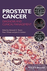 Prostate Cancer: Diagnosis and Clinical Management - ISBN 9781118347355