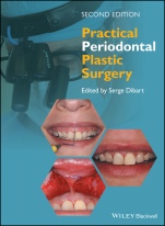 Practical Periodontal Plastic Surgery - ISBN 9781118360651