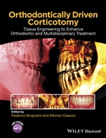 Orthodontically Driven Corticotomy: Tissue Engineering to Enhance Orthodontic and Multidisciplinary Treatment - ISBN 9781118486870