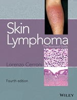 Skin Lymphoma: The Illustrated Guide - ISBN 9781118492499