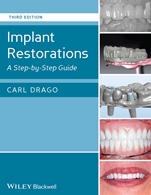 Implant Restorations: A Step–by–Step Guide - ISBN 9781118513057