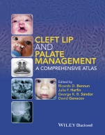 Cleft Lip and Palate Management: A Comprehensive Atlas - ISBN 9781118607541
