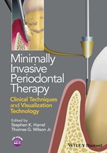 Minimally Invasive Periodontal Therapy: Clinical Techniques and Visualization Technology - ISBN 9781118607626