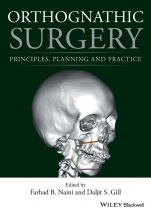 Orthognathic Surgery: Principles, Planning and Practice - ISBN 9781118649978
