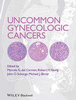 Uncommon Gynecologic Cancers - ISBN 9781118655351