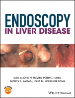Endoscopy in Liver Disease - ISBN 9781118660874