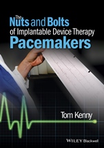 The Nuts and Bolts of Implantable Device Therapy: Pacemakers - ISBN 9781118670675