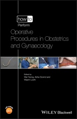 How to Perform Operative Procedures in Obstetrics and Gynaecology - ISBN 9781118672884