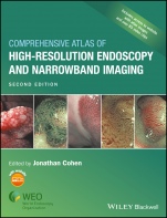 Comprehensive Atlas of High–Resolution Endoscopy and Narrowband Imaging - ISBN 9781118705933